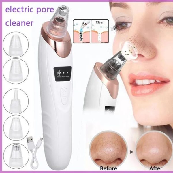 Clear Skin Confirmed: 3-Speed Face Vacuum & Blackhead Destroyer